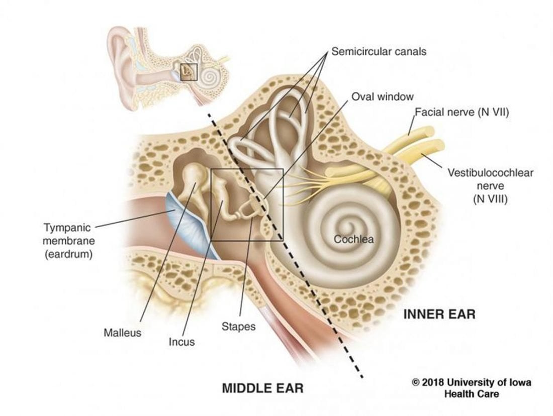 The Inner Ear (From uihc.org/health-topics/stapedectomy)