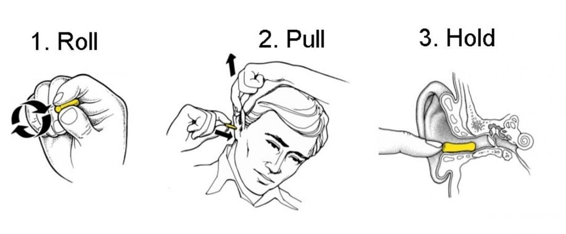 Diagram of the Roll-Pull-Hold technique (From: 3m.com)