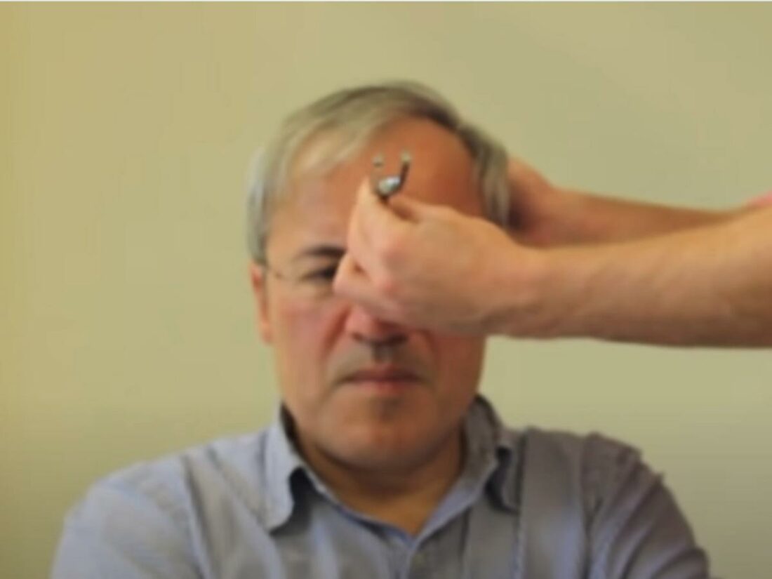 The vibrating tuning fork is then placed on the patient's forehead. (From: YouTube/Doctor O'Donovan)