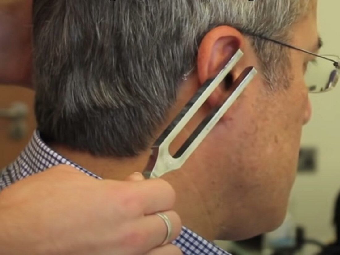 The vibrating tuning fork is moved to the patient's ear canal. (From: YouTube/Doctor O'Donovan)