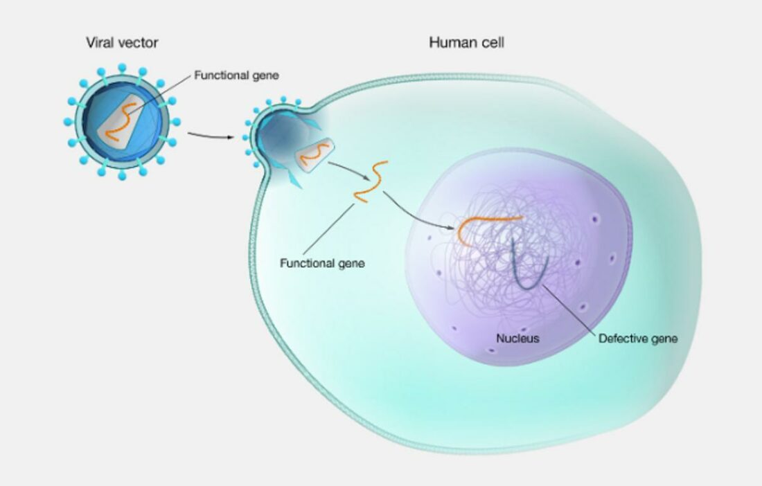 How gene therapy works. (From: National Human Genome Research Institute)